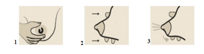 extrac2