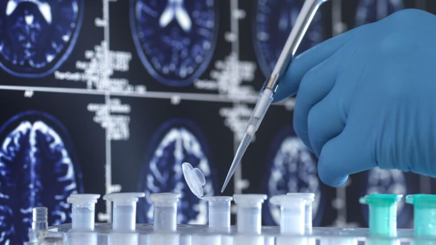 Investigacion-neurologica